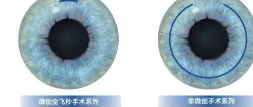 全飞秒还有